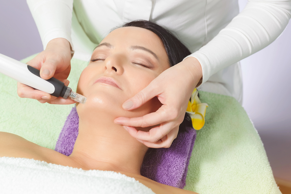 Radiofrequenz-Microneedling